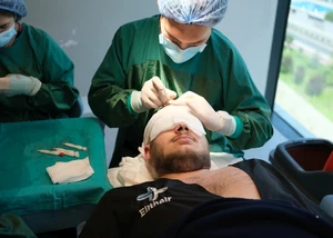 Patient und Arzt bei einer Haartransplantation