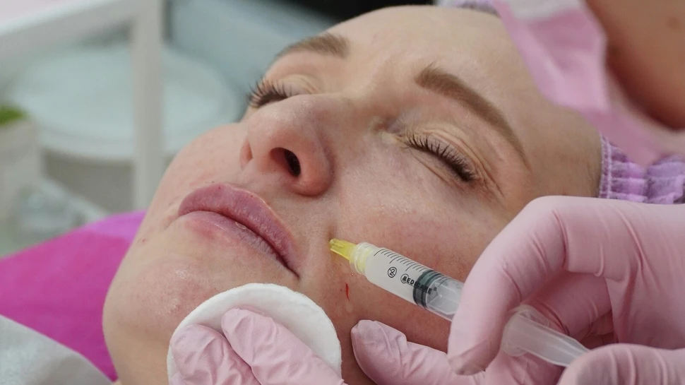 Frau bekommt Botoxspritze in die Mundpartie