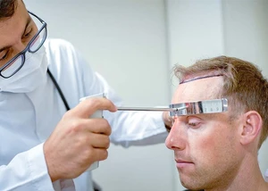 Arzt während einer Haartransplantation